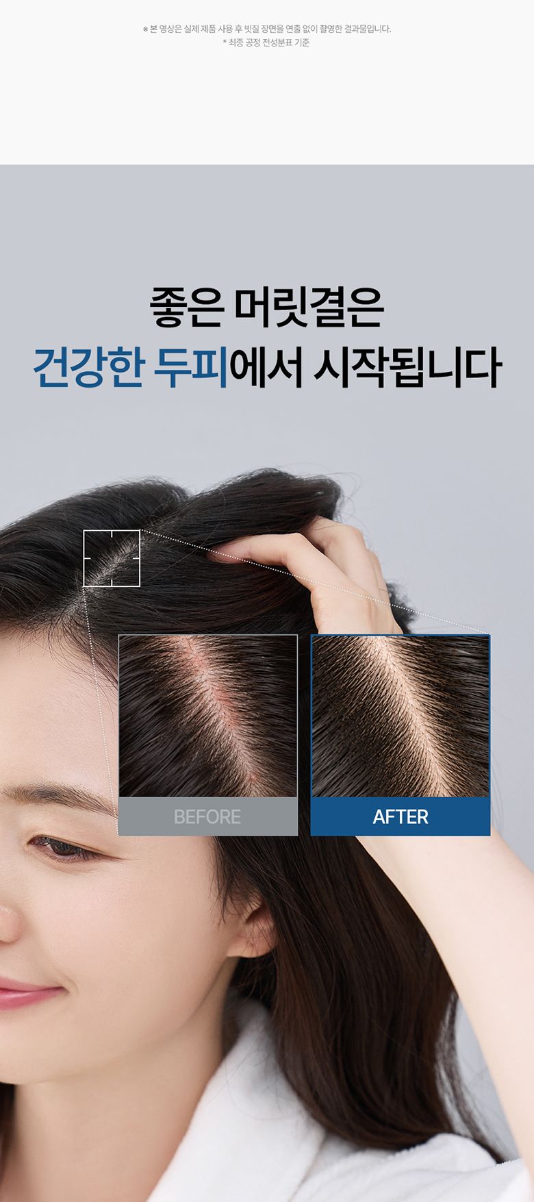 ★최쇼단독/홈쇼핑유일판매처★[최신상카이스트탈모볼륨샴푸시즌2]그래비티 PDRN 헤어 리커버리 샴푸 6개 탈모샴푸 대용량샴푸